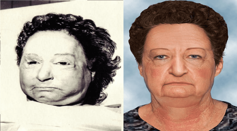 The Vernon County Jane Doe • Morbidology