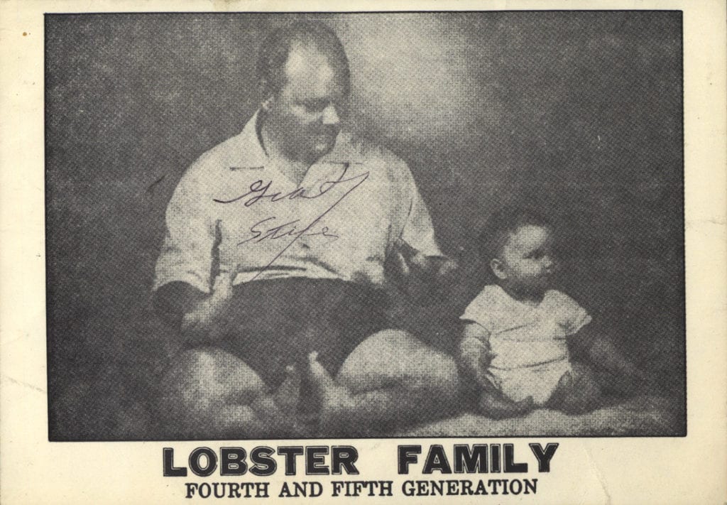 The Lobster Boy - Grady Stiles Jr.